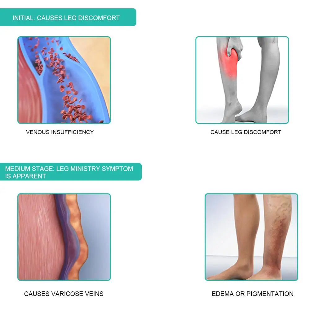1 Y Tế Nén Tất 30-40mmHg Trung - đánh giá và giá Compression Sock Medical